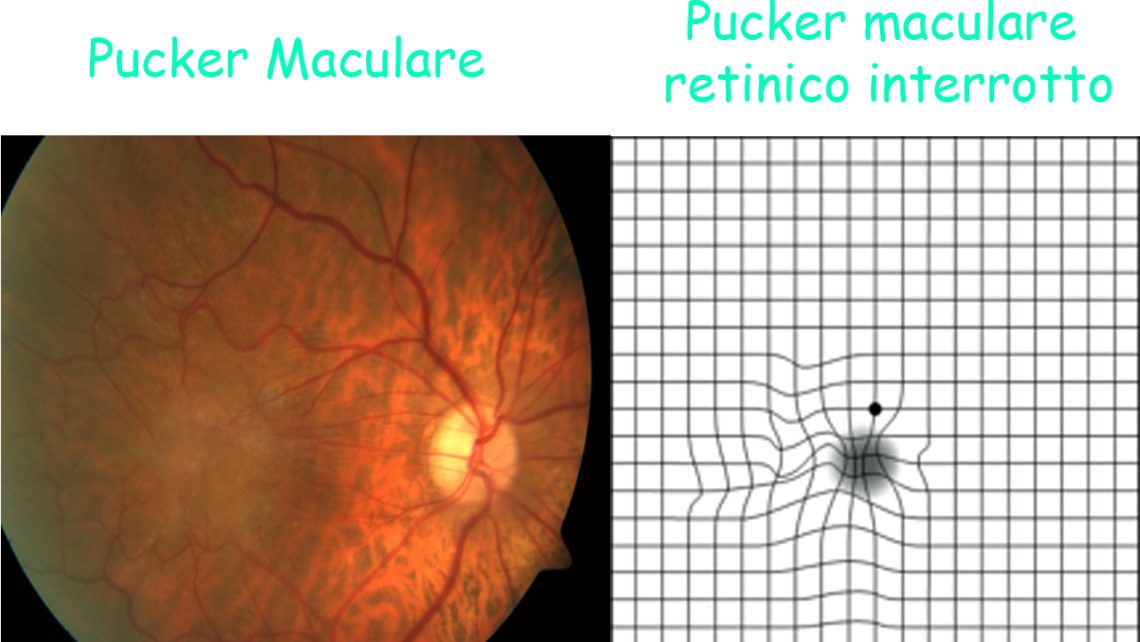 benessere Archivi Rapisarda Oculisti Prenota la tua visita Oculistica